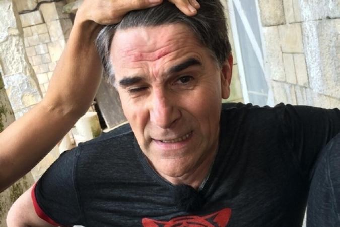 Fort Boyard 2014 : Tex après ses chutes dans le Percolateur (05/07/2014)